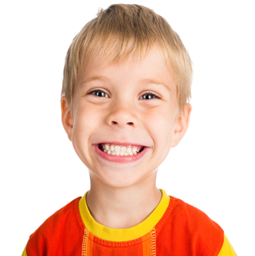 White Fillings White Fillings